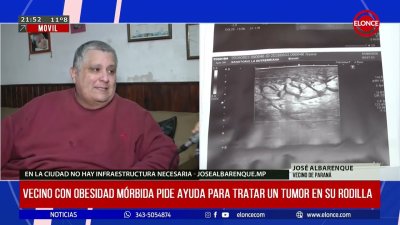 Vecino con obesidad m&oacute;rbida pide ayuda para tratar un tumor en su rodilla